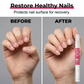 Prevenção do hábito de roer unhas em crianças e adultos